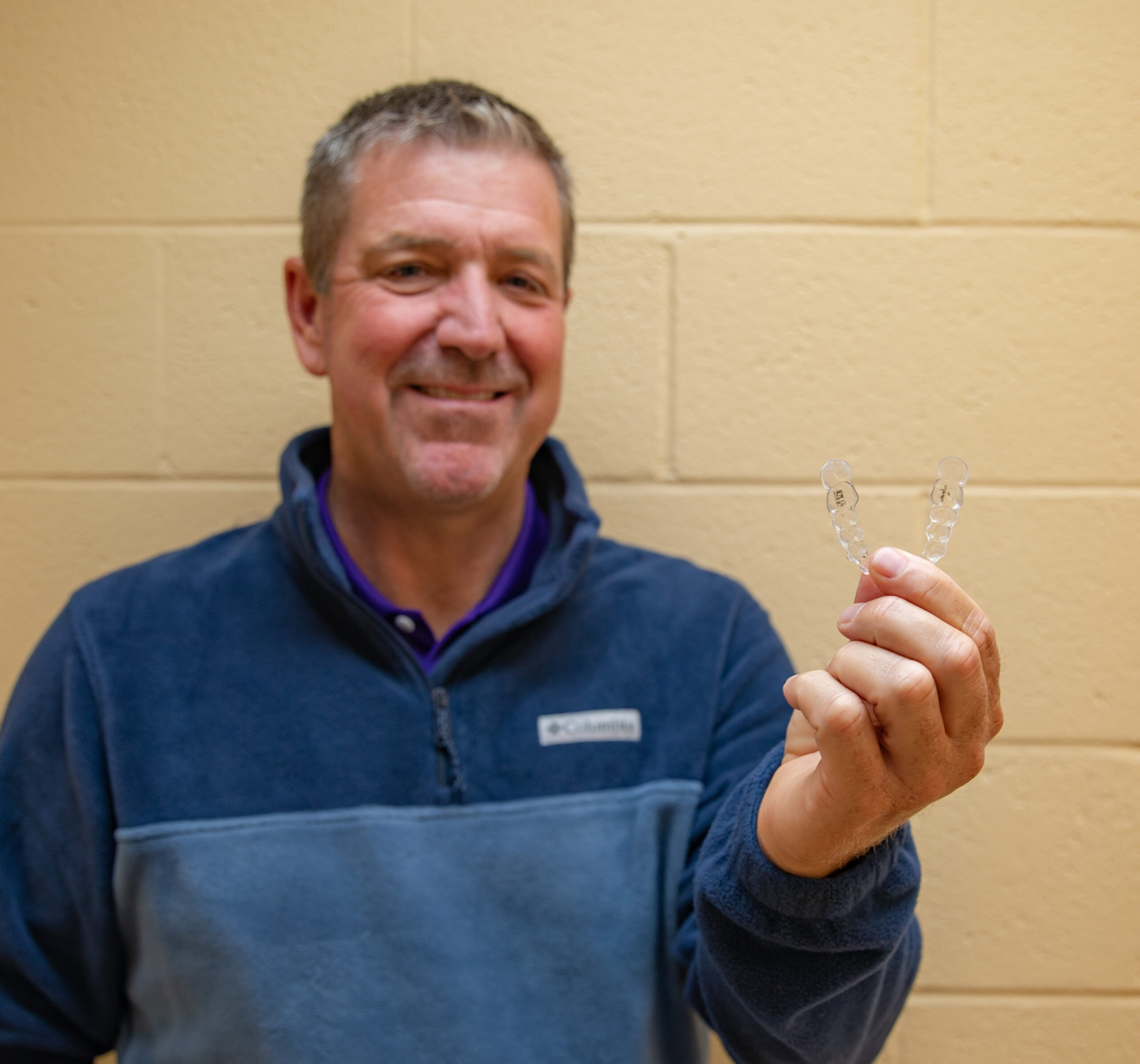 invisalign aligners on plastic model